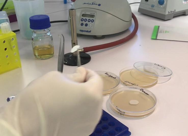 Кишечная палочка шигелла