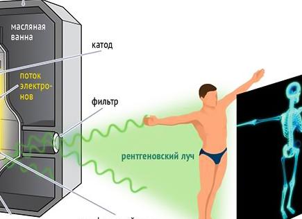 Флюорография как работает
