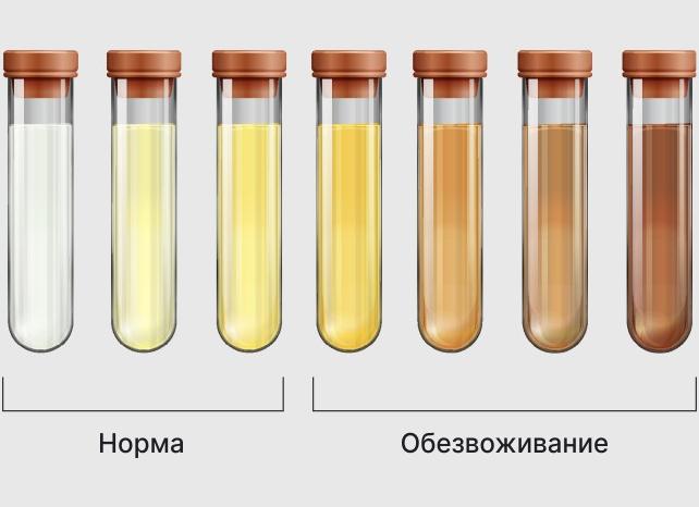 Цвет мочи норма и отклонения
