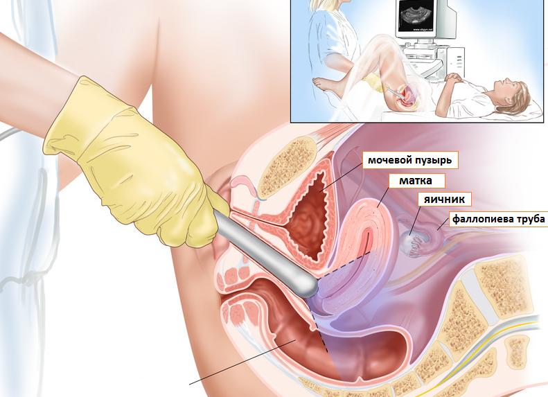 Цдк что это в узи