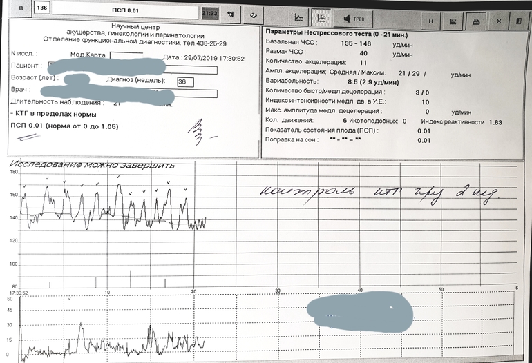 Ктг количество акцелераций