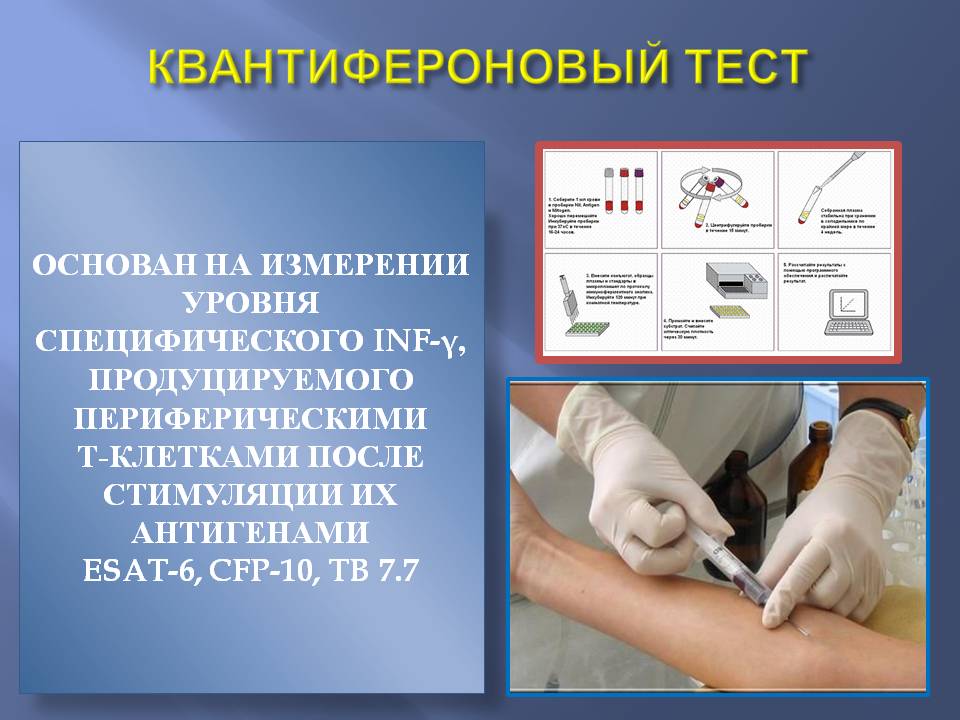Квантифероновый тест это