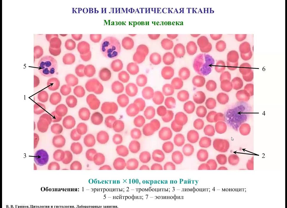 Мазок на гистологию