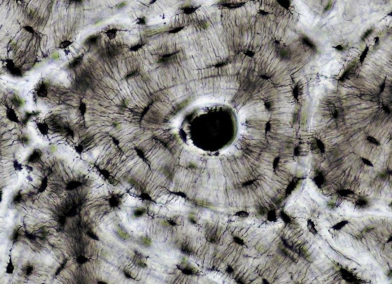 Костная соединительная ткань под микроскопом