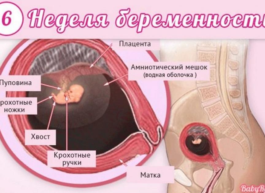 Как выглядит выкидыш на 6 неделе фото