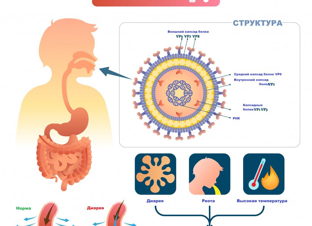 Как определить ротавирус Как определить ротавирус