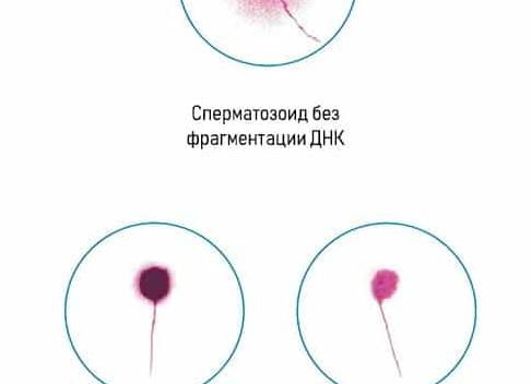 Фрагментация днк спермограммы