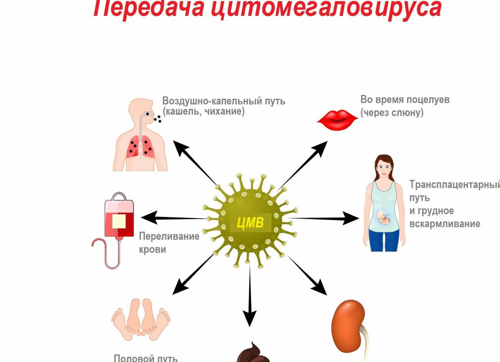 Цмв анализ крови что это
