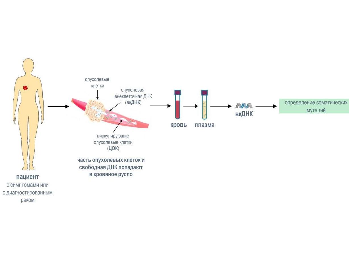 Цистометрия при кисте яичника