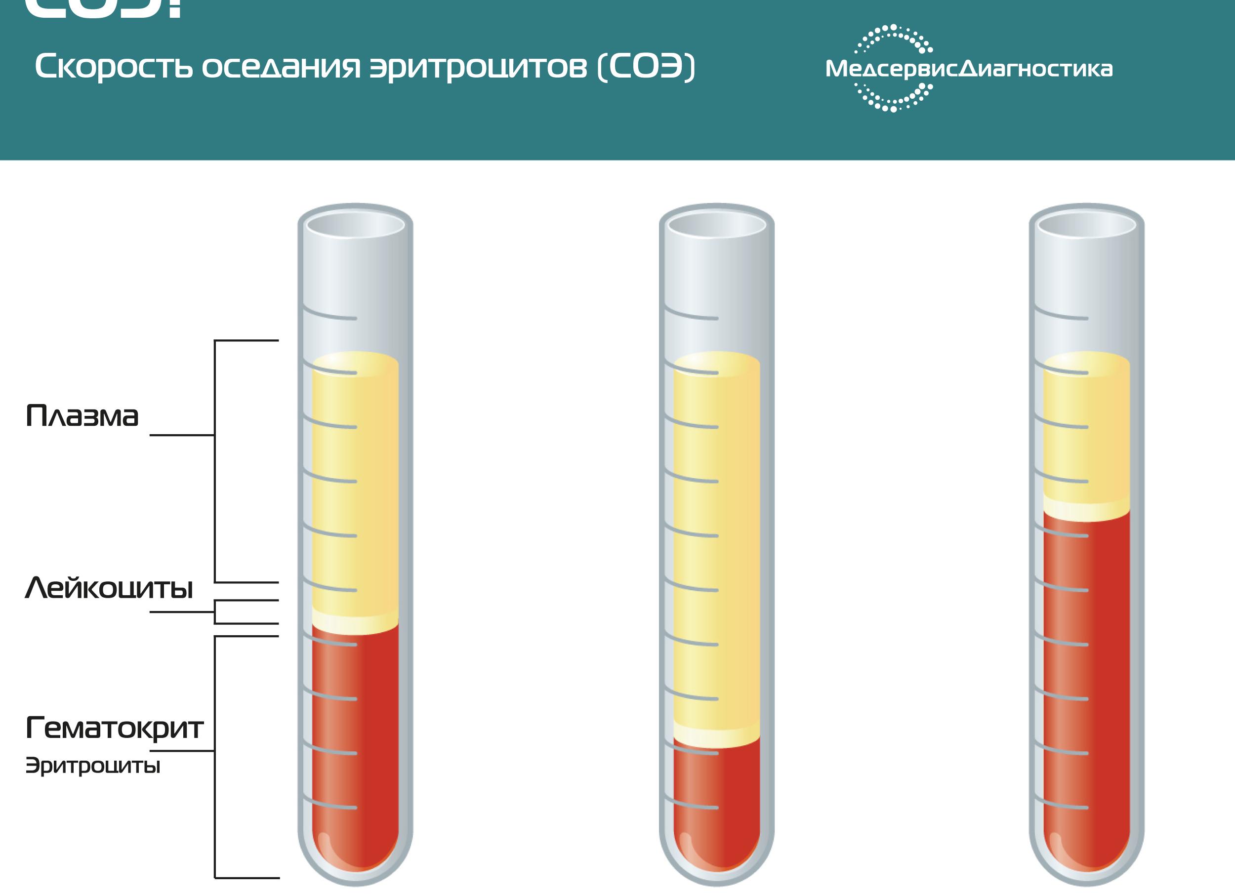 Что означает соэ