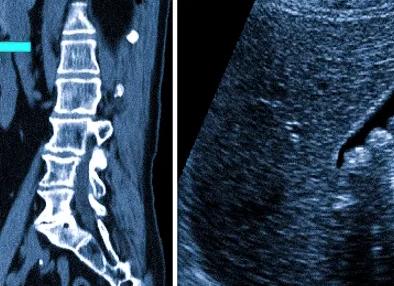Что лучше узи или мрт брюшной полости