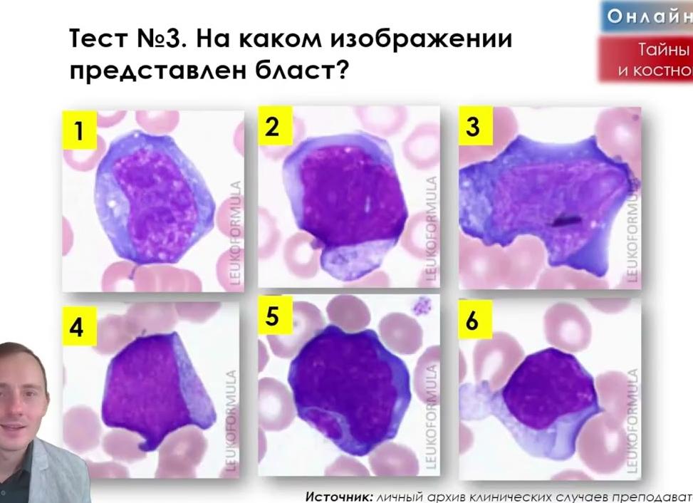 Бласты в крови норма у здорового человека