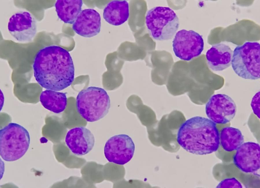 Анализ крови на наличие раковых клеток