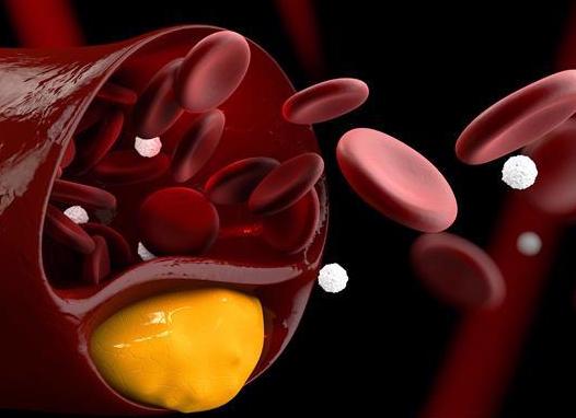 Анализ крови лпнп расшифровка Анализ крови лпнп расшифровка