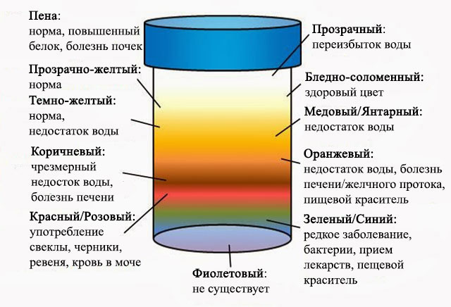 Моча цвета чая