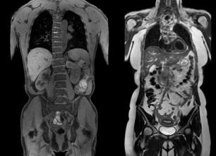 Мрт внутренних органов