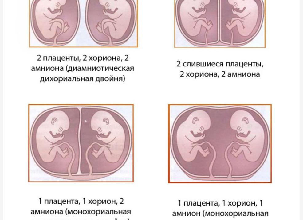 Моно ди двойня что это