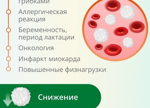 Лейкоциты 100 в моче