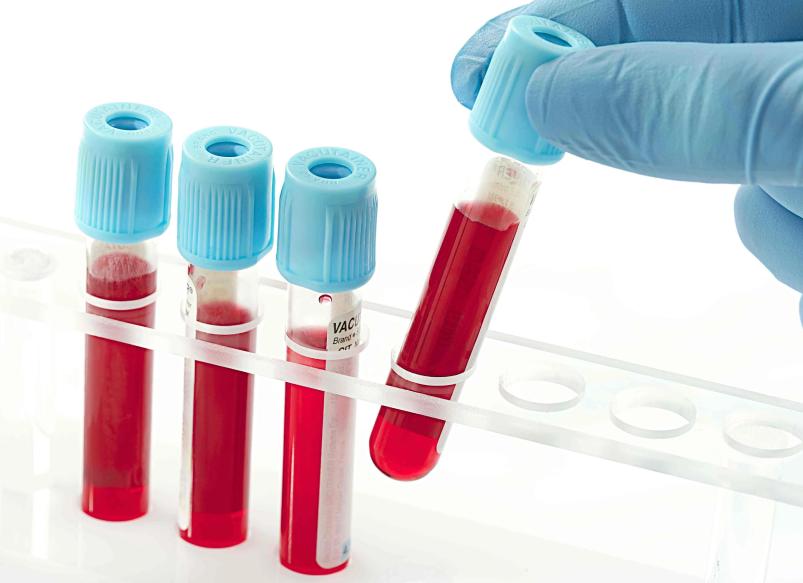 Коагулограмма что это за анализ норма