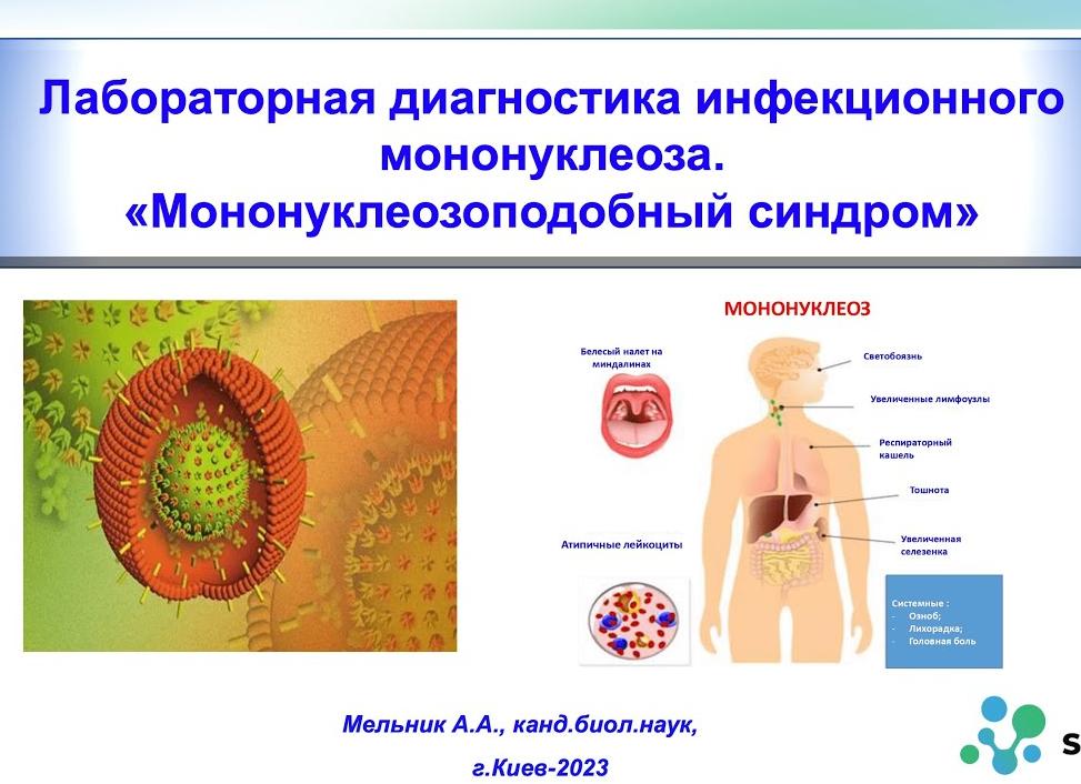 Инфекционный мононуклеоз лабораторная диагностика