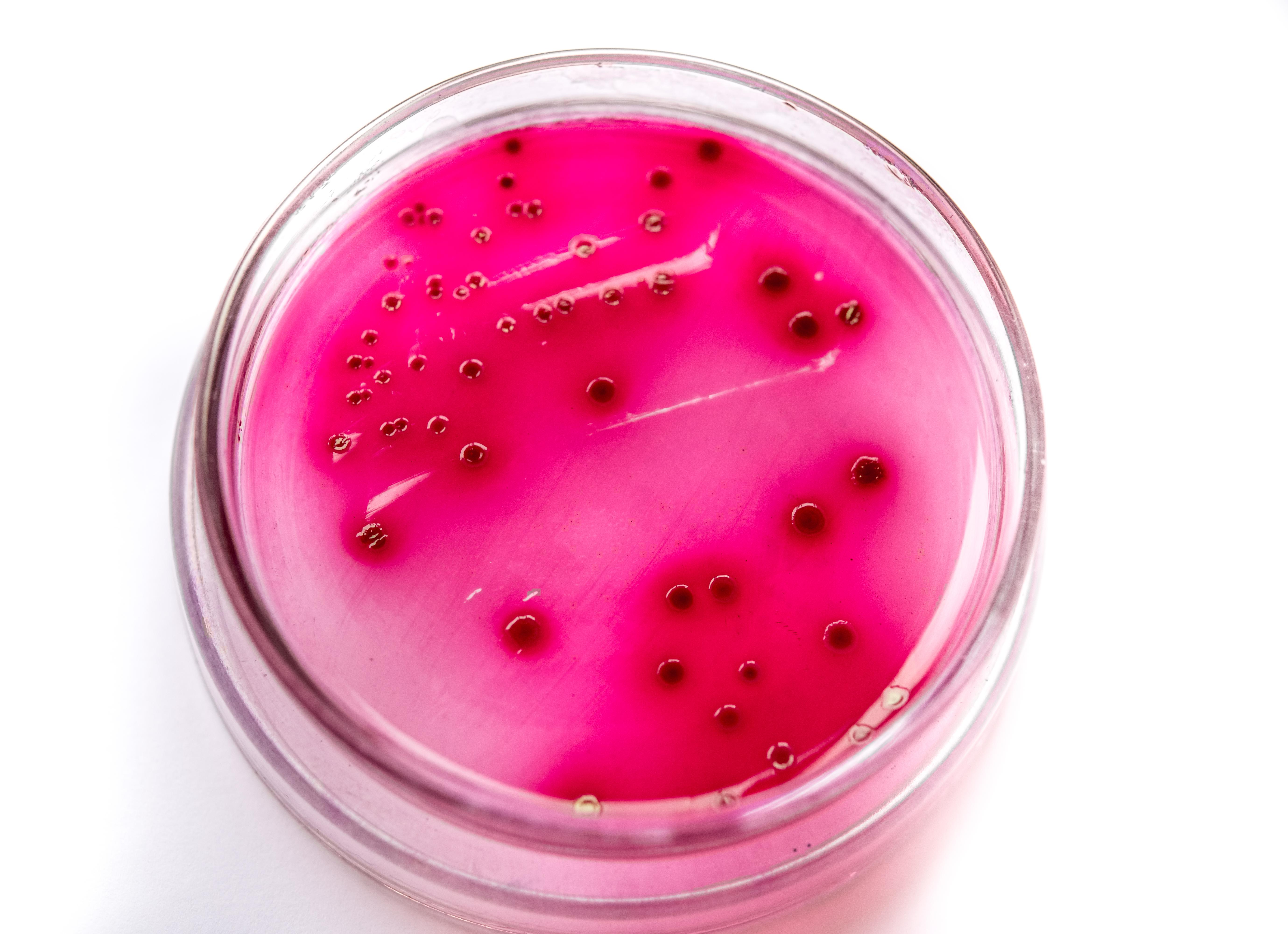 Что такое кишечная палочка