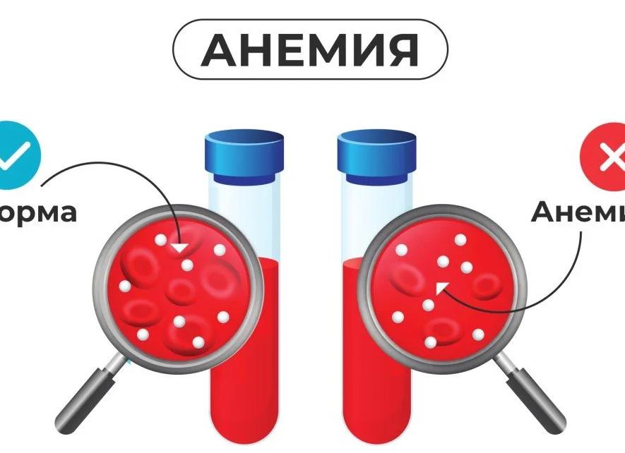 Анализ на железо