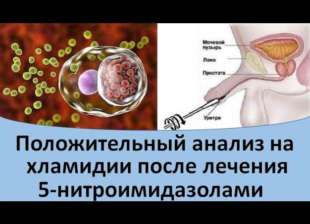 Анализ на хламидии