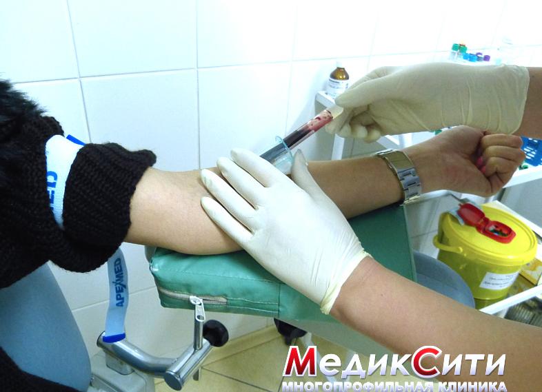 Аццп анализ крови норма и расшифровка результатов таблица