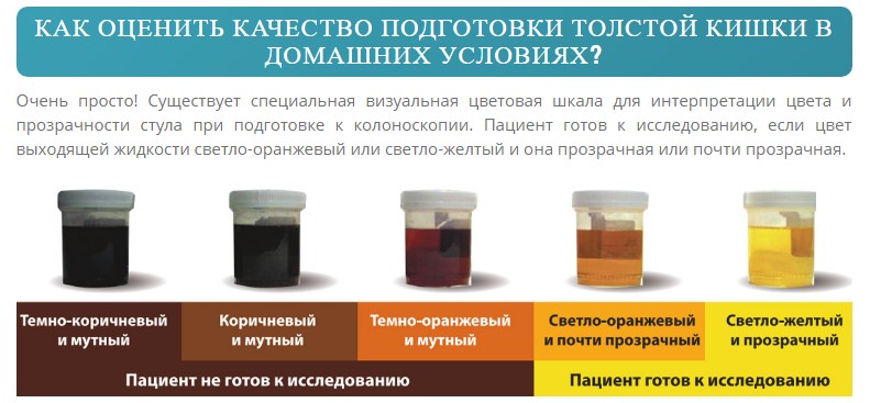 Как подготовиться к колоноскопии кишечника в домашних условиях