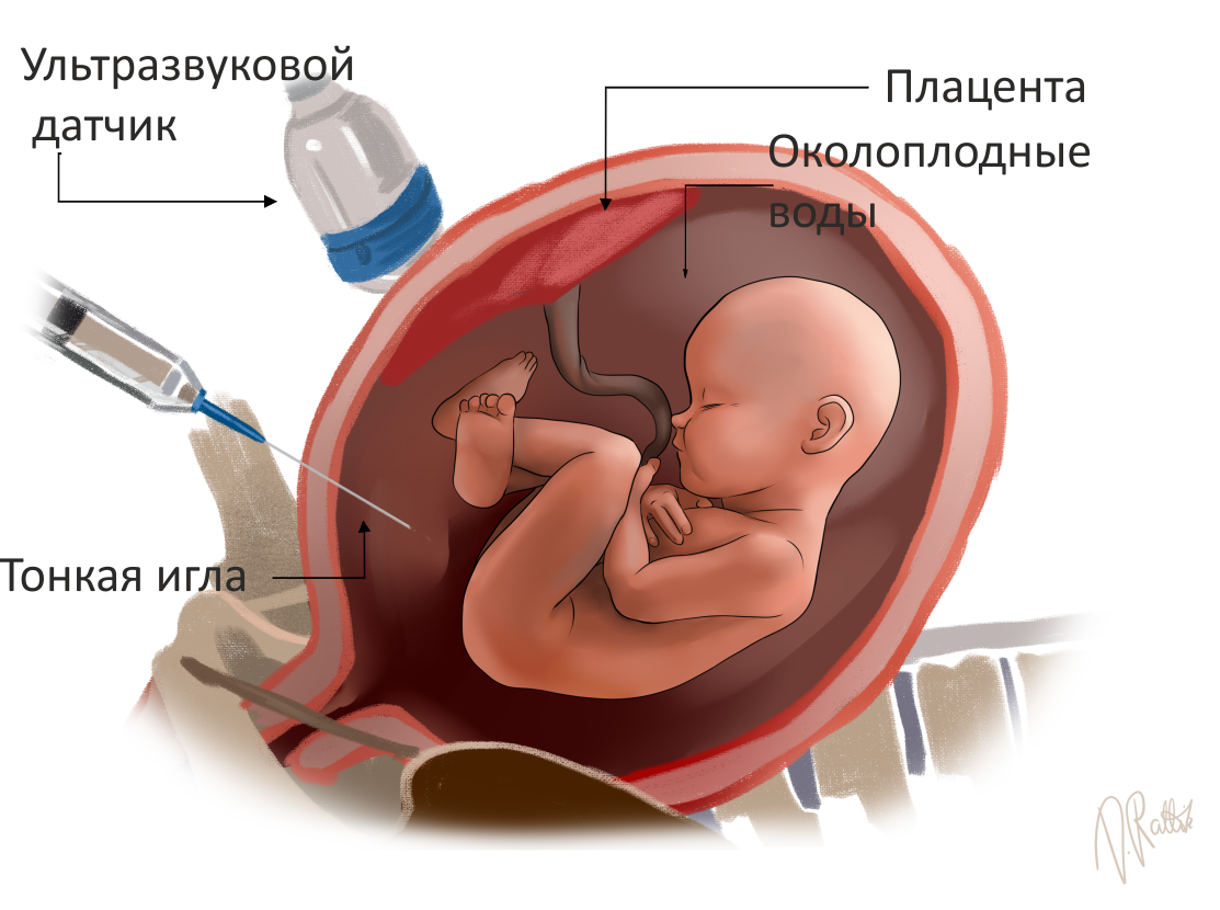 Как узнать мальчик или девочка родится по внешним признакам