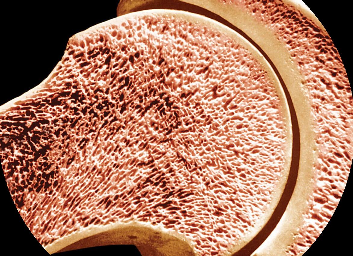Как выглядит костный мозг