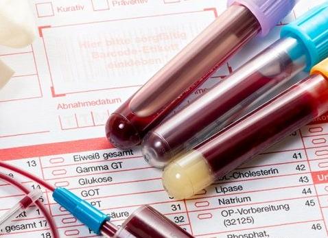 Как называется анализ крови Как называется анализ крови