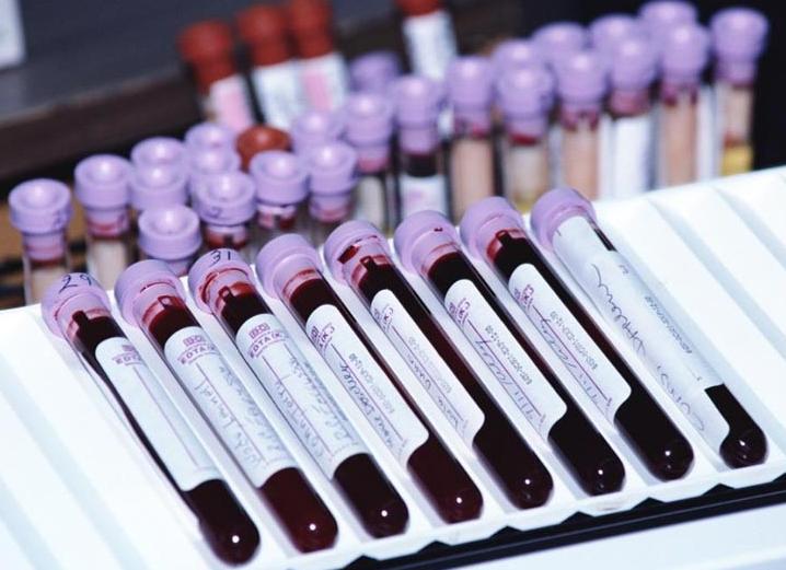 Иммунологические исследования крови расшифровка