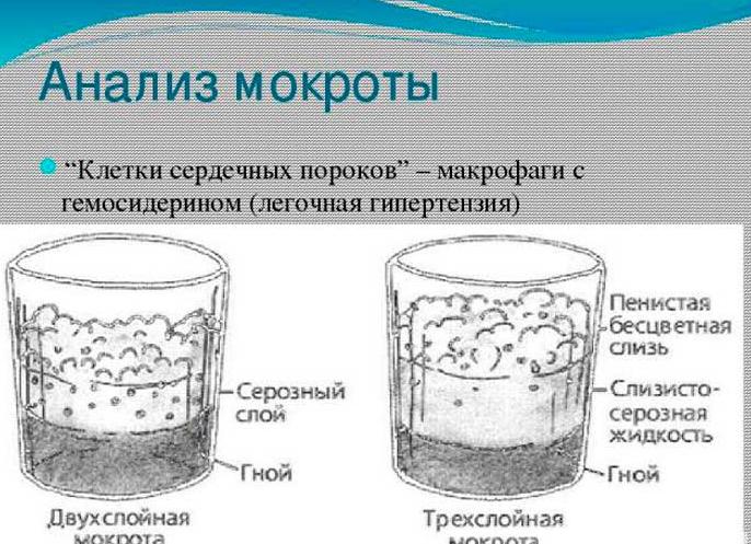 Анализ мокроты на вк что это