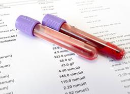 Анализ крови на аст что это такое и каковы нормальные значения