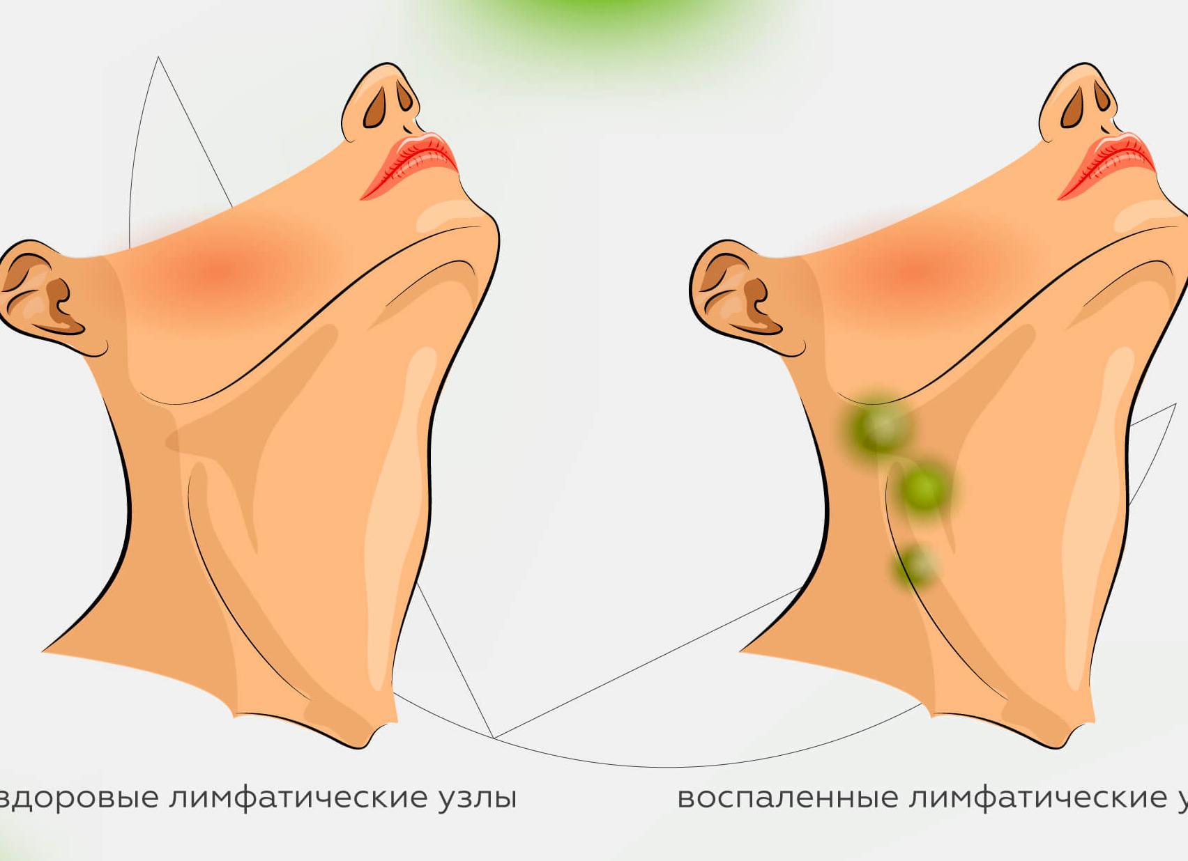 Анализ эпштейн барра что это