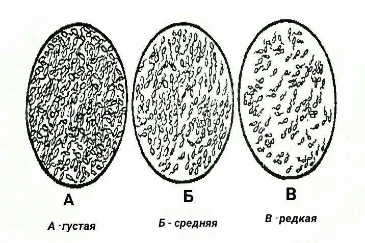 Как проверить сперму