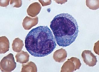 Моноциты в крови