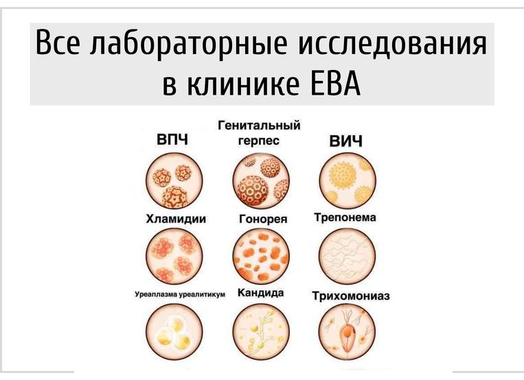 Мазок на иппп