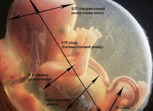Ктр узи что это такое