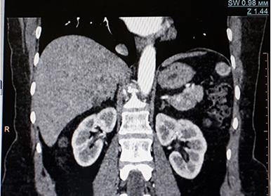 Кт брюшной полости какие органы проверяют Кт брюшной полости какие органы проверяют