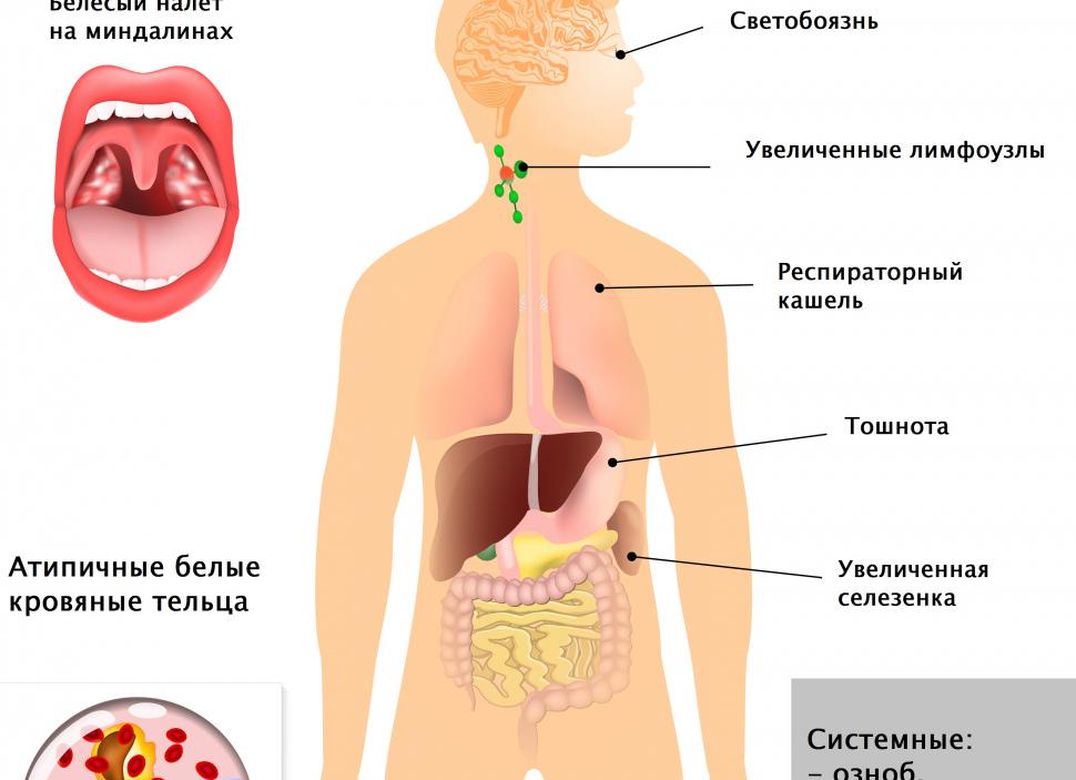 Кровь на мононуклеоз