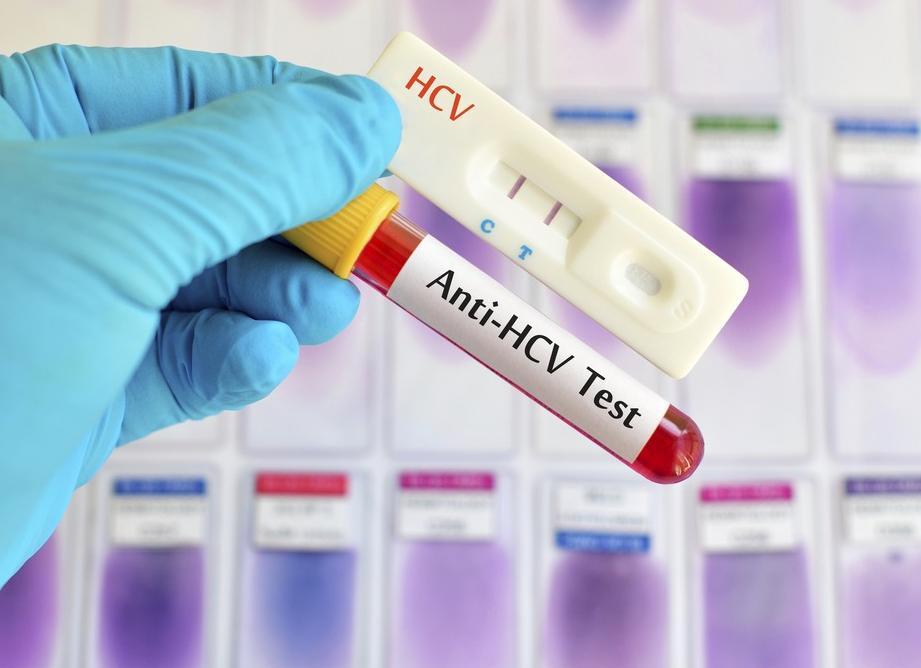 Кровь на гепатит в и с как обозначается Кровь на гепатит в и с как обозначается