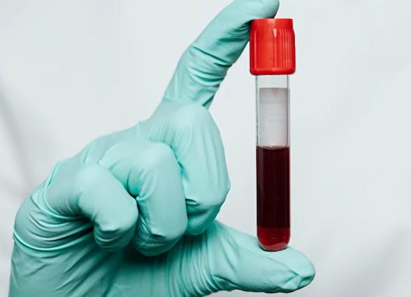 Кровь на альфафетопротеины назначают с целью выявления Кровь на альфафетопротеины назначают с целью выявления