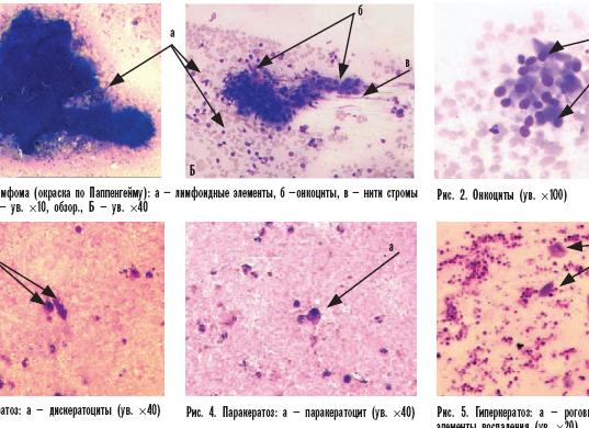 Клеточный детрит что это