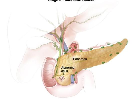 Как проверить состояние поджелудочной железы