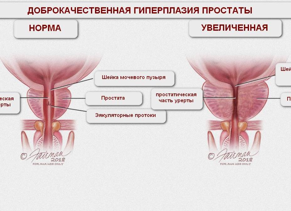 Гормоны предстательной железы