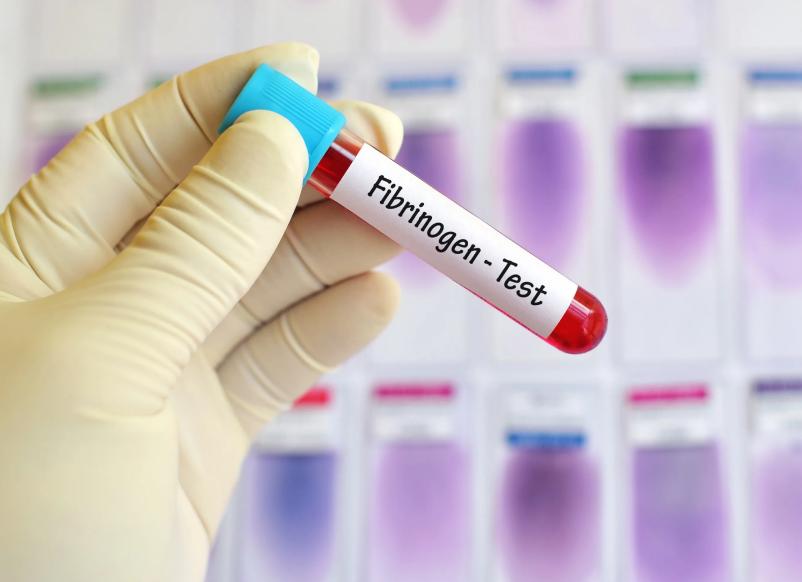 Фибриноген в крови норма у женщин по возрасту таблица