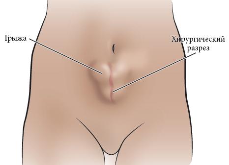 Что можно пить от желудка