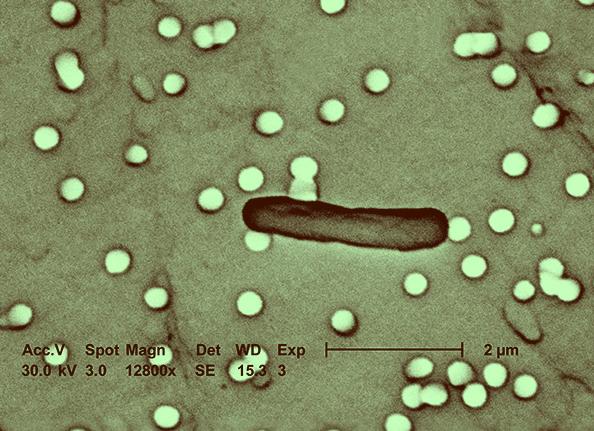 Бактерии в кале Бактерии в кале